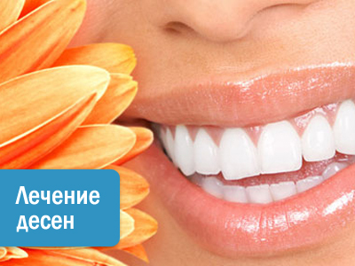Лечение десен