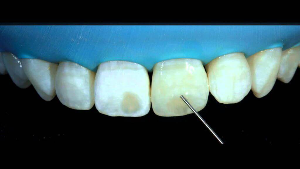 лечение зубов icon.jpg