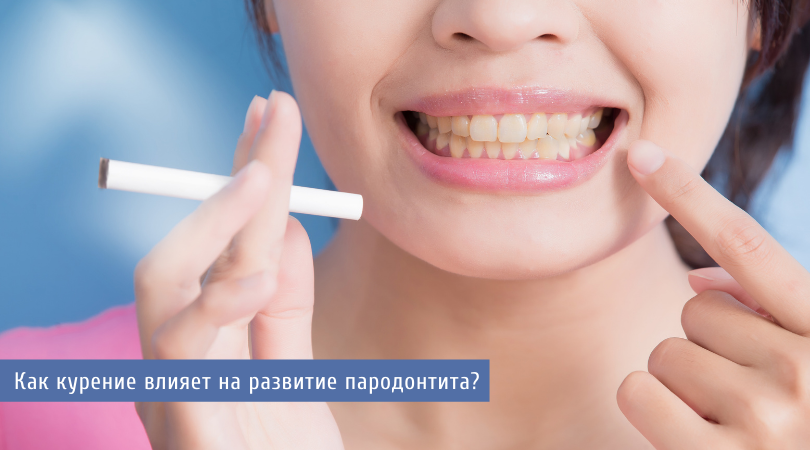 Как курение влияет на развитие пародонтита?