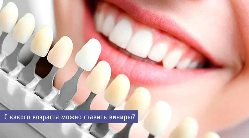 со скольки лет можно ставить виниры