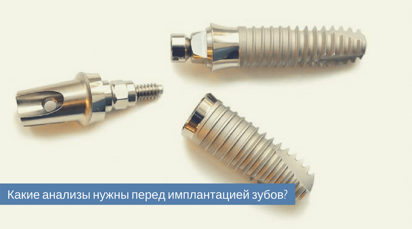 анализы перед имплантацией зубов.png