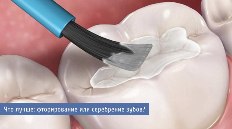Фторирование или серебрение зубов ребенку?