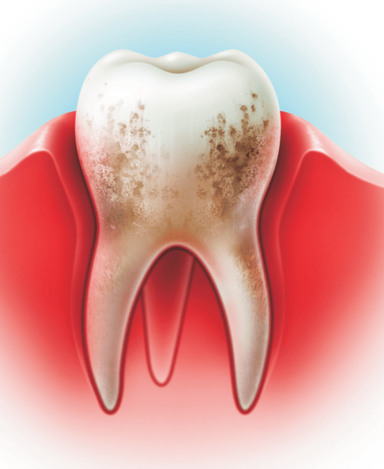 Причины подвижности зубов