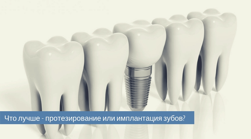 что лучше протезирование или имплантация зубов.jpg