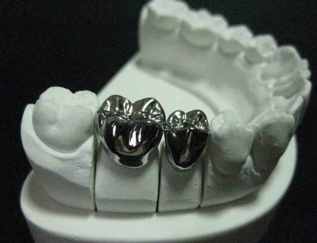 Металлические цельнолитые коронки
