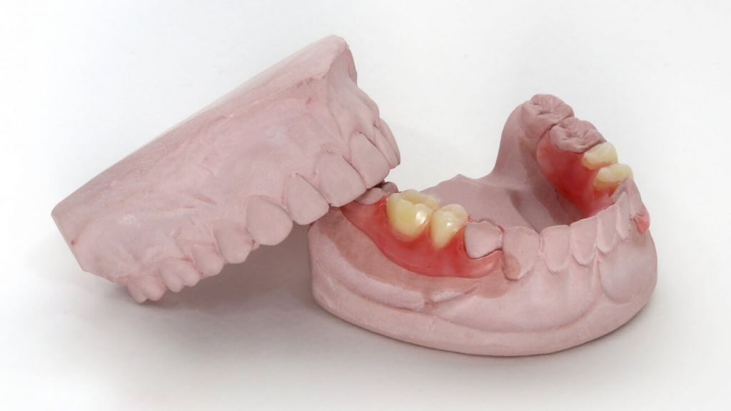 Временный зубной протез