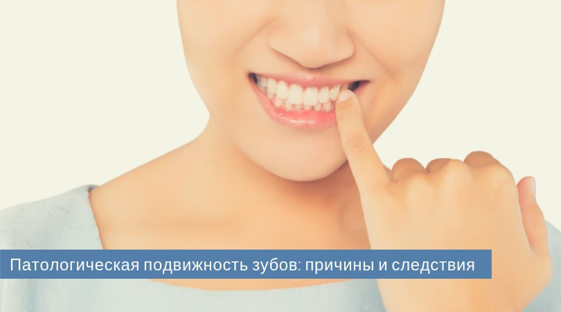 Подвижность зубов