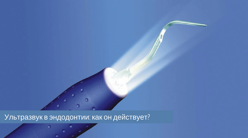 ультразвук в эндодонтии.png